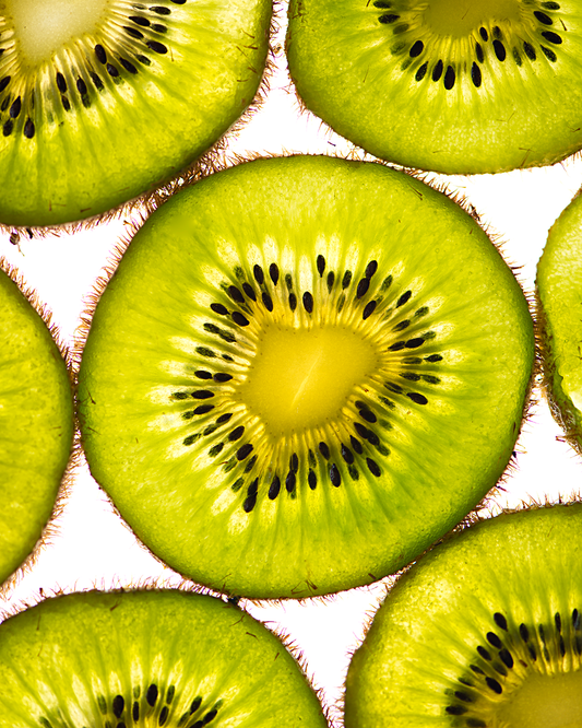 Metal prints, Kiwi